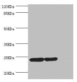 DTYMK Antibody