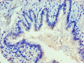 DVL2 Antibody