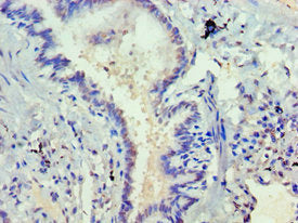 DVL2 Antibody