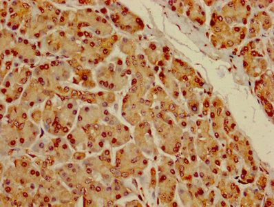DYRK3 Antibody