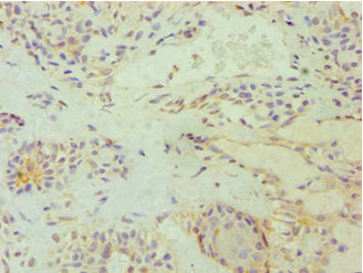 E2F6 Antibody