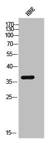 Phospho-CSNK1A1/CSNK1A1L (Y294) Antibody