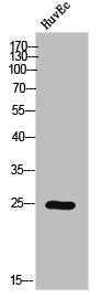 Phospho-CSNK2B (S209) Antibody