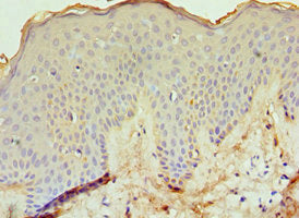 ECE1 Antibody