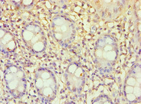 ECE2 Antibody