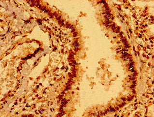 ECSCR Antibody