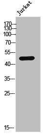 Phospho-CTBP1 (S422) Antibody