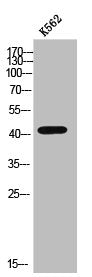 CTSD Antibody