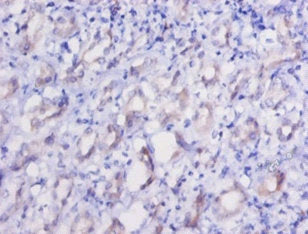 EEF2 Antibody