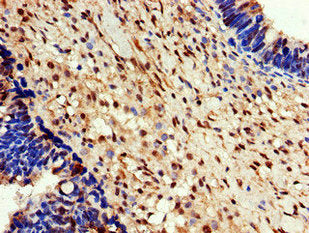 EEF2K Antibody