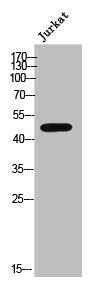 PPM1L Antibody