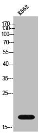 GUSBP1 Antibody