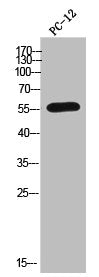 CYP2A6 Antibody