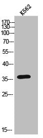 ADRB3 Antibody