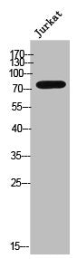Phospho-ADRBK1 (S685) Antibody