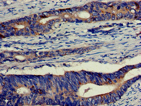 EIF4B Antibody