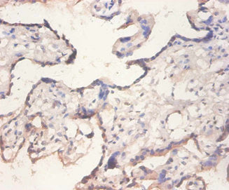 EIF4EBP2 Antibody