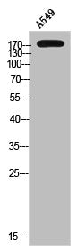 Phospho-SGK223 (Y413) Antibody