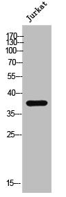 ZDHHC15 Antibody