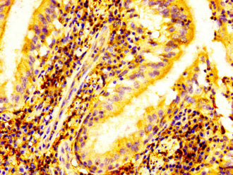 ELK3 Antibody