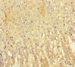 EML2 Antibody