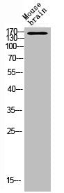 DAPK1 Antibody