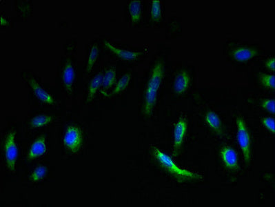 EMP3 Antibody