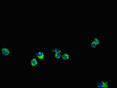 ENTPD7 Antibody