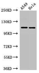 EPHA5 Antibody