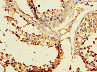EPHB2 Antibody