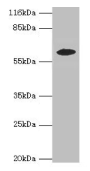 EPHX2 Antibody