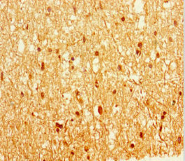 EPM2A Antibody