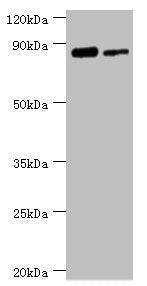 ERCC2 Antibody