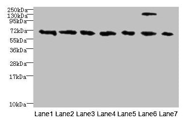 TRPM2 Antibody