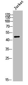 DHODH Antibody