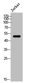 Phospho-DPYSL2 (T509) Antibody