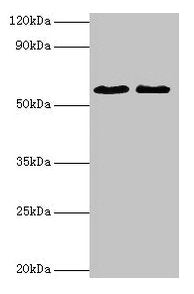 ESR2 Antibody