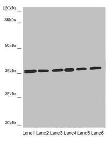 ETFA Antibody