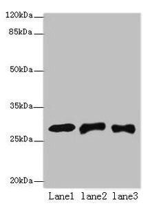 ETHE1 Antibody