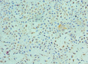 ETV6 Antibody