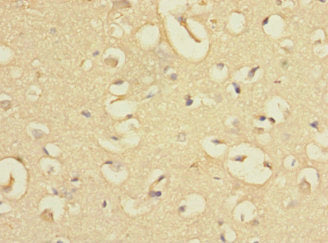 EVI2A Antibody