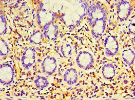 EWSR1 Antibody