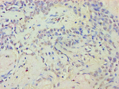 EYA2 Antibody
