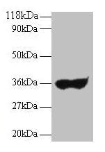 IgG Antibody