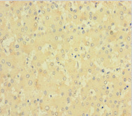 F11 Antibody