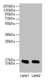 FABP1 Antibody