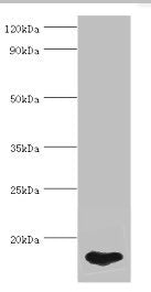 FABP5 Antibody