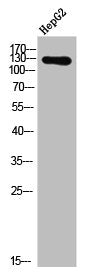 Phospho-EPHA2/EPHA3/EPHA4 (Y588/596) Antibody