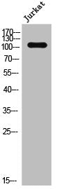 Phospho-EPHA2/EPHA5 (Y594) Antibody