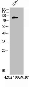Phospho-CTTN (Y421) Antibody